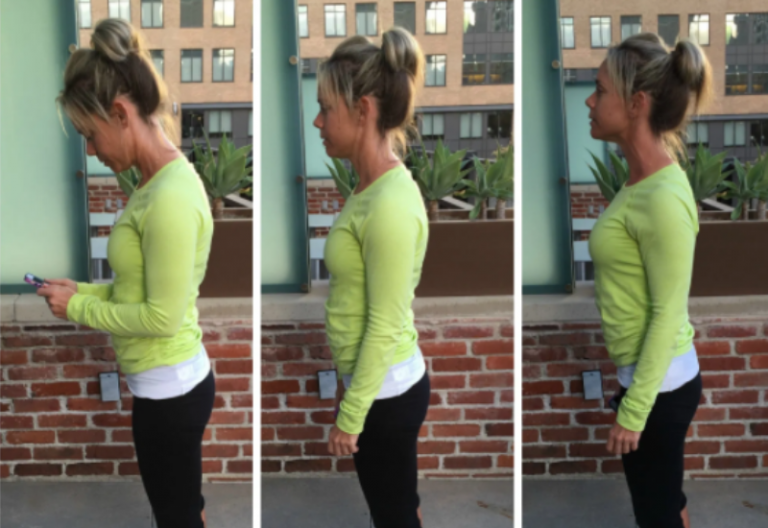 Exercises to Prevent Tech Neck Cover